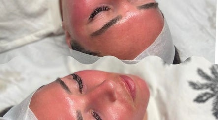 Facial treatment at Rhijuvenate Skin & Healing, Royston, England, GB showing glowing, rejuvenated skin.