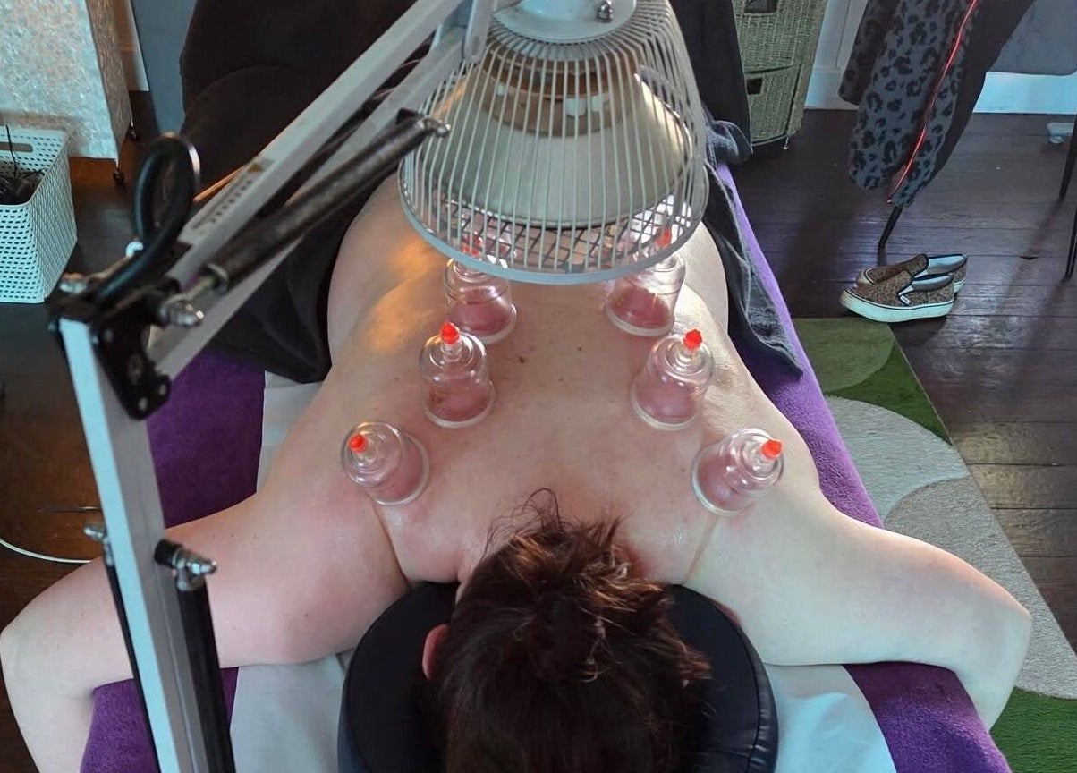 Relaxing cupping therapy at Macroom Massage and Holistic Clinic in County Cork, County Cork, IE.