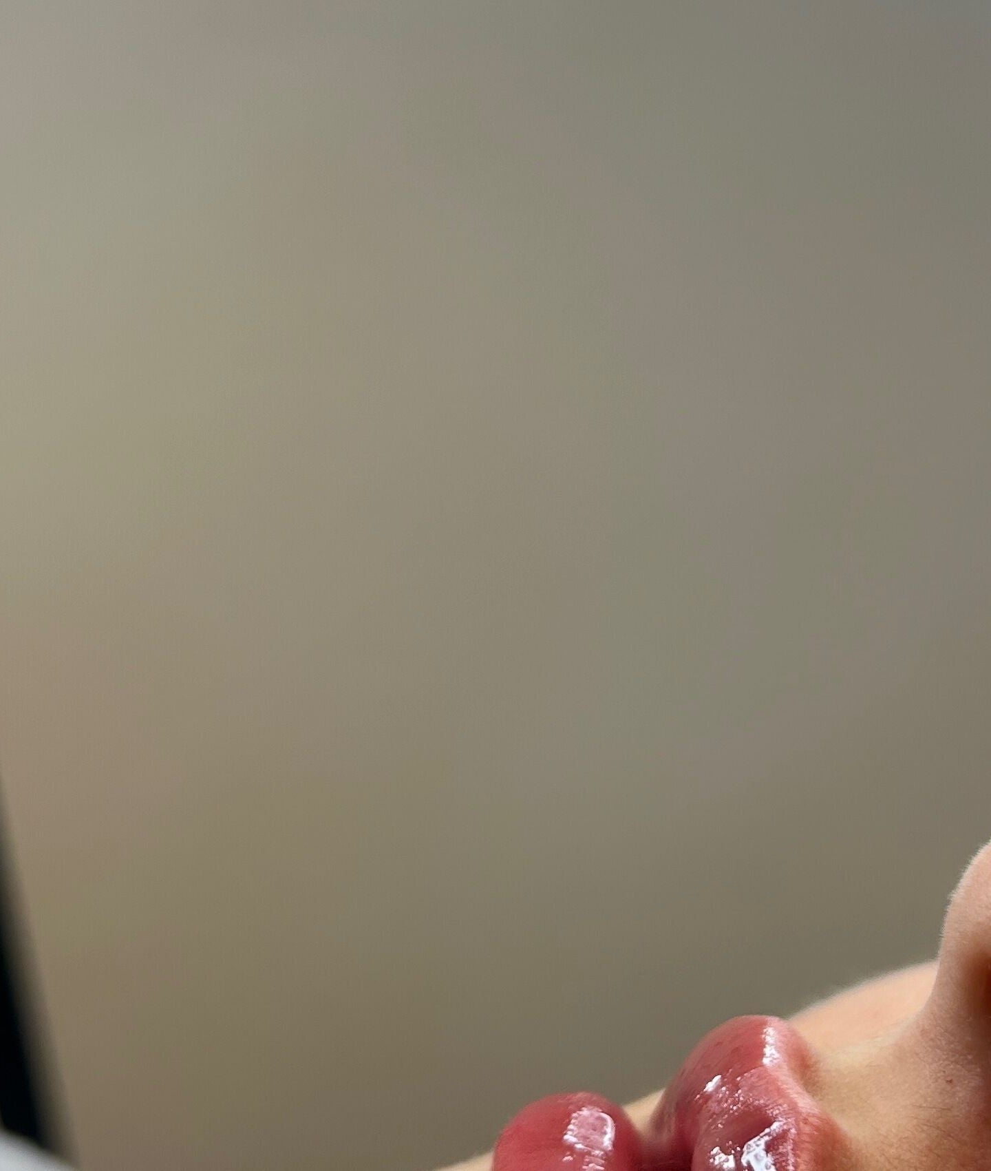 Close-up of a person's lips after treatment at NM Aesthetics Clinic and Training, Barnby Dun, England, GB.