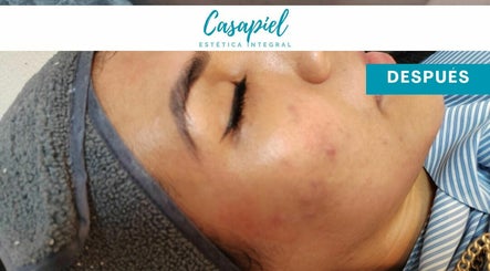 Casapiel Estetica Integral image 3
