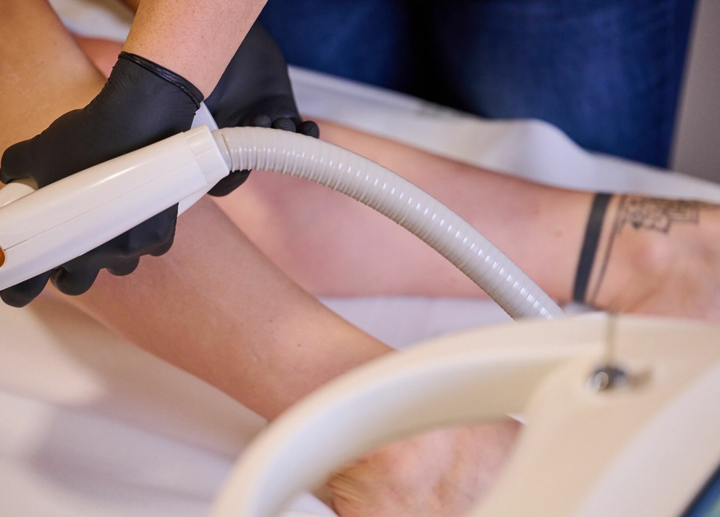 Lézeres szőrtelenítés a GK Medical - Esztétikai, Orvosi Központban, Szombathely, HU.