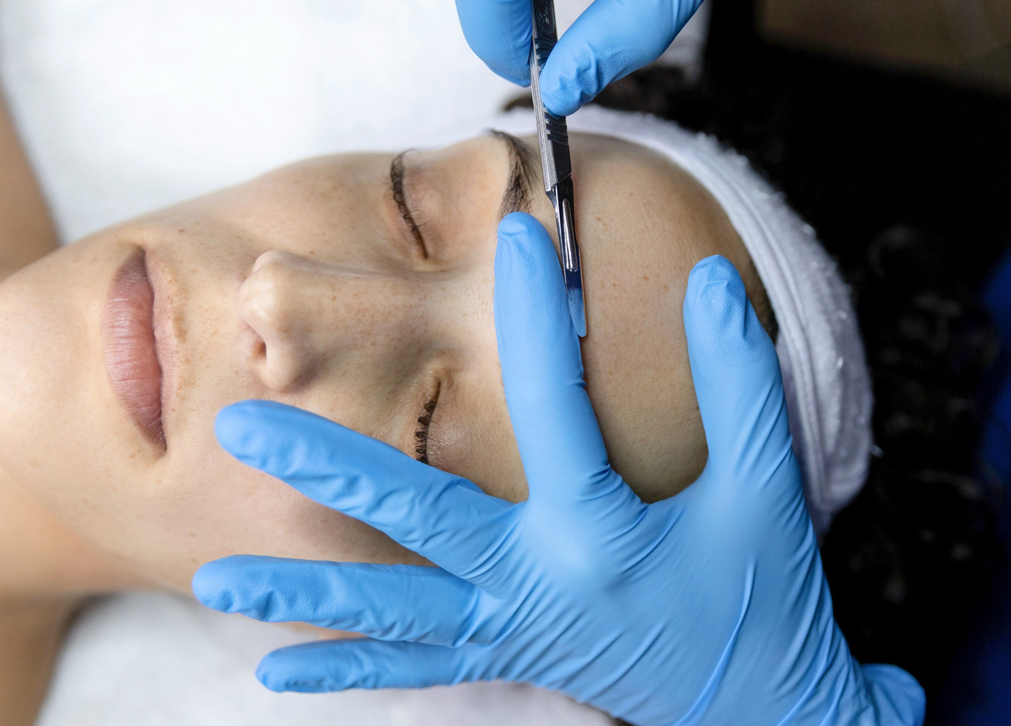 Dermaplaning at MicroMeeks Skin Studio in Port Coquitlam, British Columbia on calm client with blue gloves.