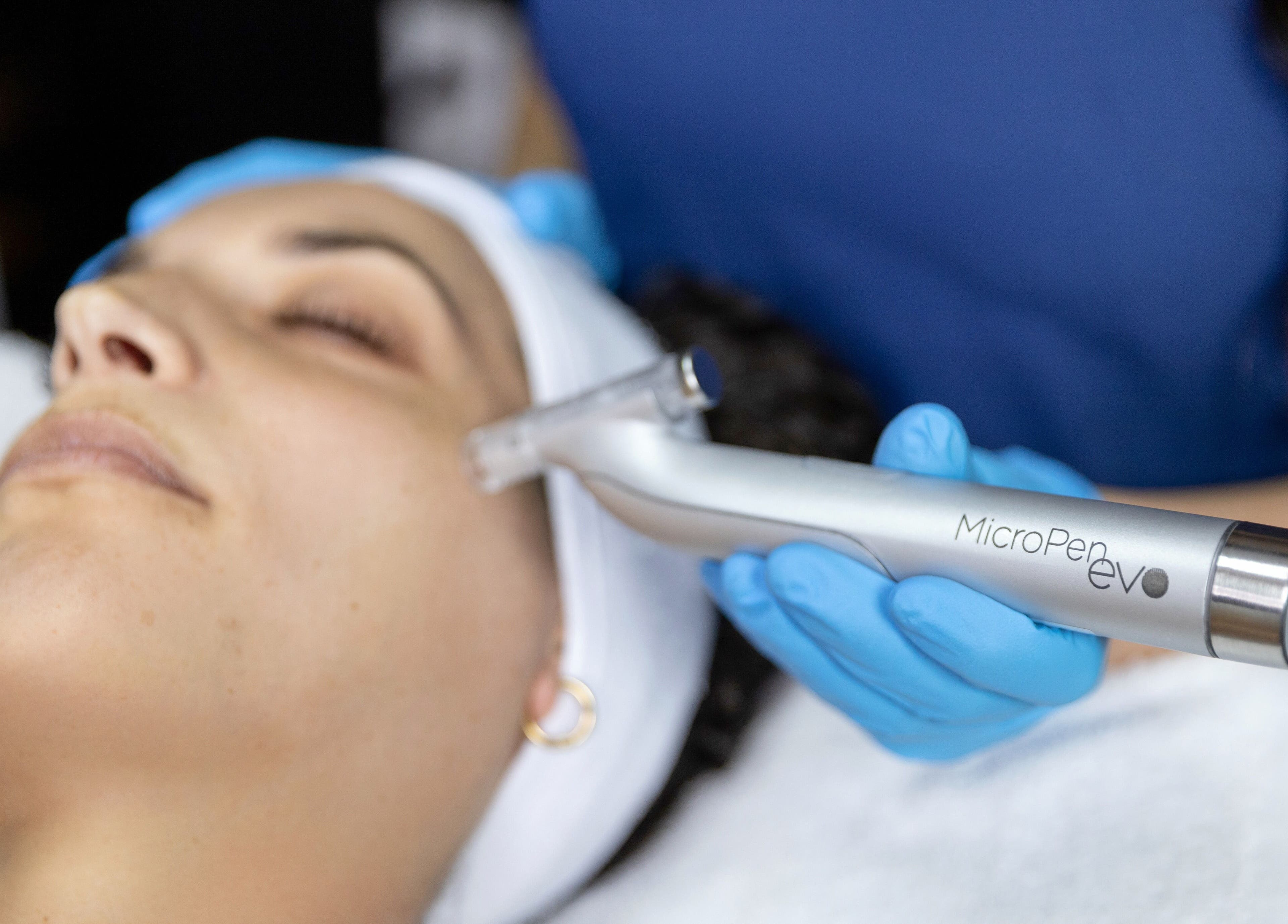 Facial microdermabrasion at MicroMeeks Skin Studio in Port Coquitlam, British Columbia, CA.