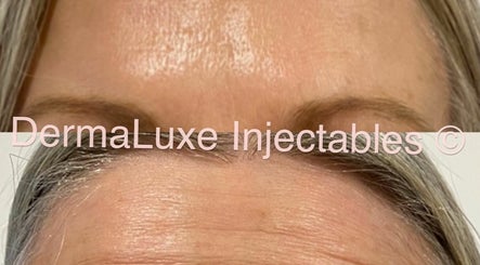 DermaLuxe Injectables | Geelong image 2