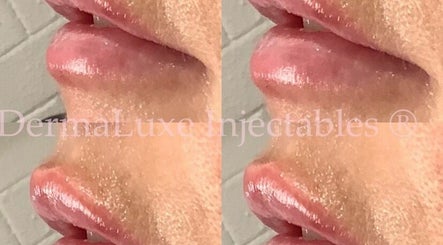 DermaLuxe Injectables | Geelong image 3