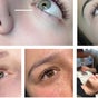 MÄnea Enhancement