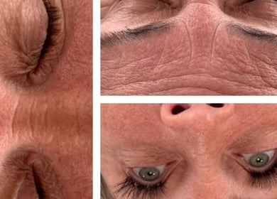 Close-up of smooth skin post-treatment at Spray&Glow Leeds, Leeds, England, GB showcasing visible wrinkle reduction.