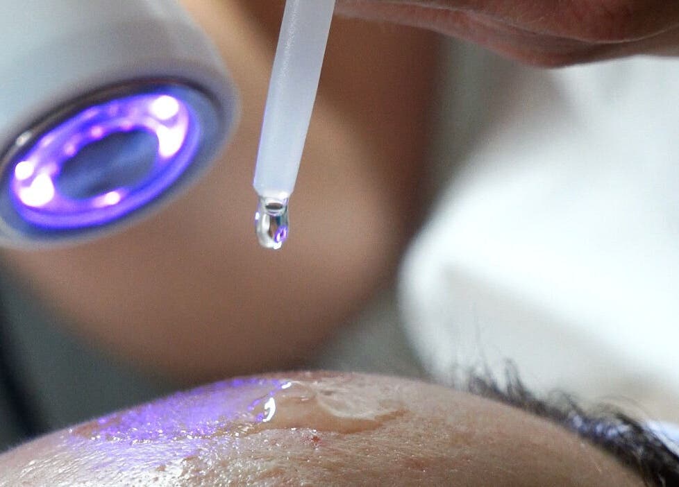 Hydration treatment at Perfect Skin Studio, Kato Polemidia, Limassol, CY enhancing skin glow.