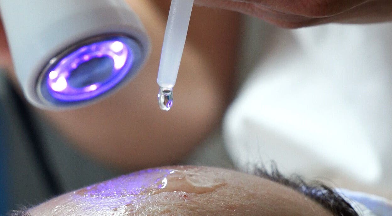 Hydration treatment at Perfect Skin Studio, Kato Polemidia, Limassol, CY enhancing skin glow.