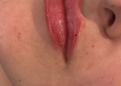 Close-up of lips treated at The Beauty Room, Princes Risborough, England, GB. Showcasing natural beauty enhancement.