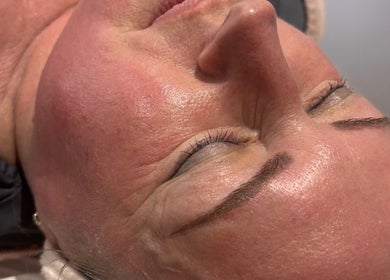 Facial treatment at The Beauty Room, Princes Risborough, England, GB, enhancing skin glow.