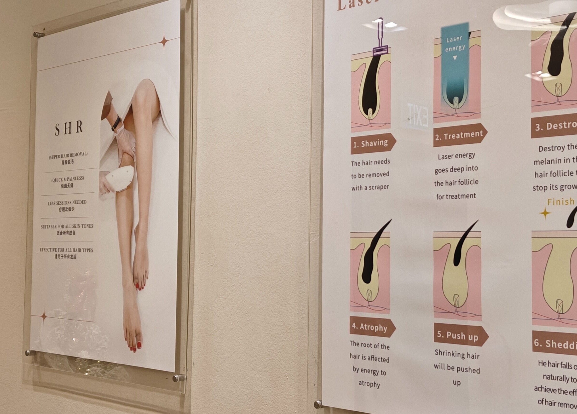 Hair removal posters at Clean and Tidy Orchard, Singapore, Singapore, SG, showcasing laser treatment steps.