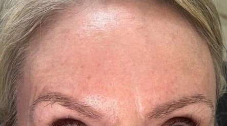 ABL clinic - Aesthetics By Leah image 3