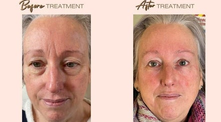 Be Young Facial Aesthetics by Christina зображення 2