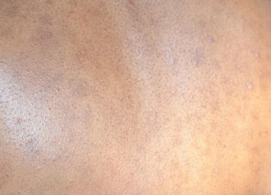 Close-up of smooth skin detail at Skinjockey, Lagos, Lagos, NG showcasing texture improvement.
