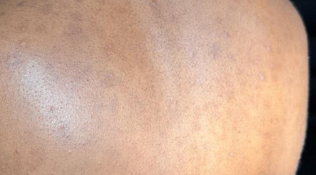 Close-up of smooth skin detail at Skinjockey, Lagos, Lagos, NG showcasing texture improvement.