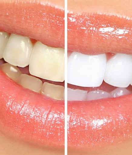 AZ Teeth Whitening Spa and Gems – kuva 2
