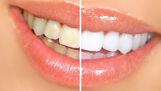 AZ Teeth Whitening Spa and Gems