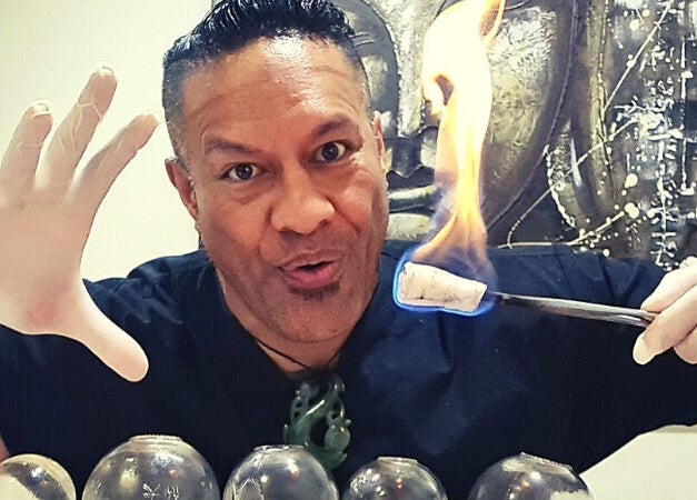 Practitioner at Mana Physiques in South Toowoomba, Queensland, AU, performing cupping therapy with flame.