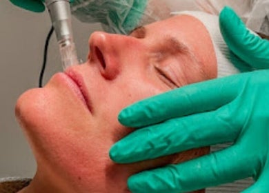 Facial treatment at Seu Momento Beauty, Subiaco, Western Australia, AU with a microdermabrasion tool.
