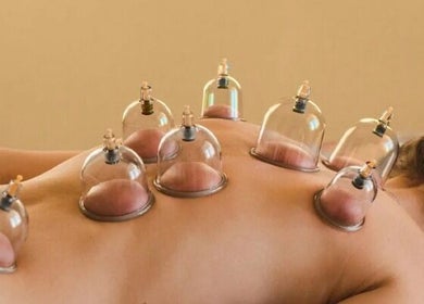 Cupping therapy session at LBeauty, Limerick, County Limerick, IE showing cups on a client's back.