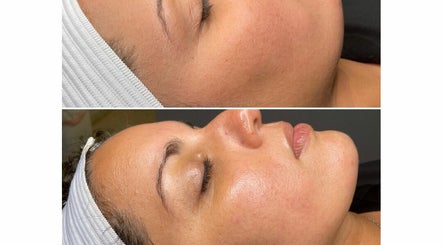 KY Brows and Skin image 2