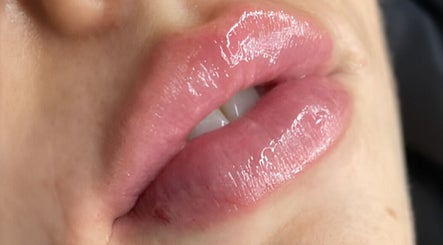 Glossy lips treatment at CPA Aesthetics, Glasgow, Scotland, GB, showcasing smooth and shiny lip enhancement.