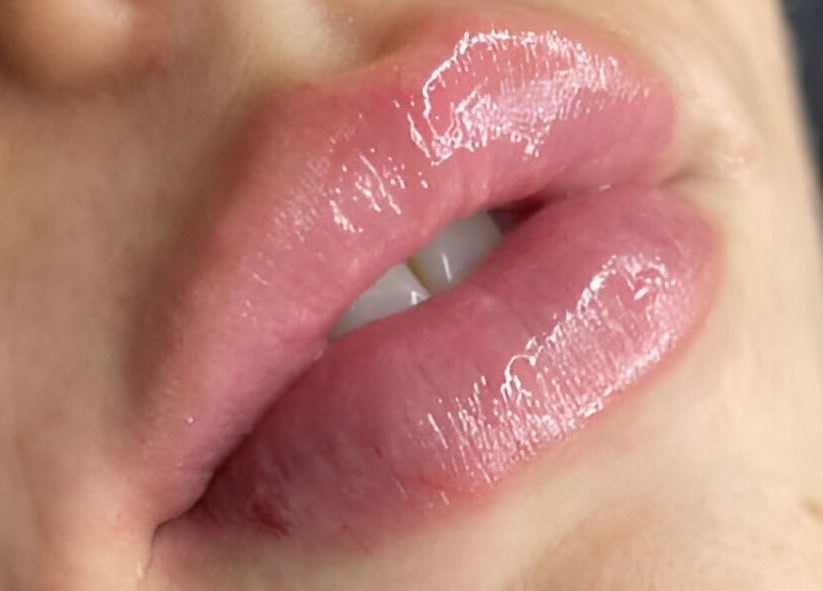 Glossy, natural lips beauty by CPA Aesthetics in Glasgow, Scotland, GB.