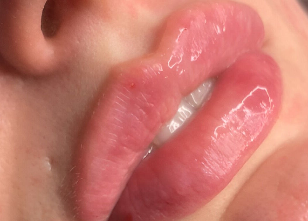 Close-up of glossy lips after treatment at CPA Aesthetics, Glasgow, Scotland, GB.