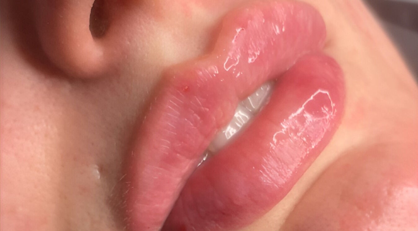 Close-up of glossy lips after treatment at CPA Aesthetics, Glasgow, Scotland, GB.