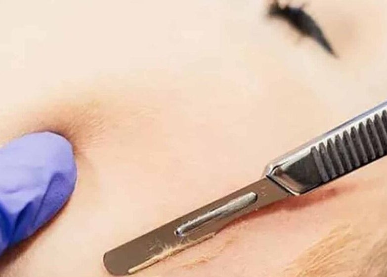 Close-up of dermaplaning treatment at Lashes and Skincare by Stefani, Austin, Texas, US.