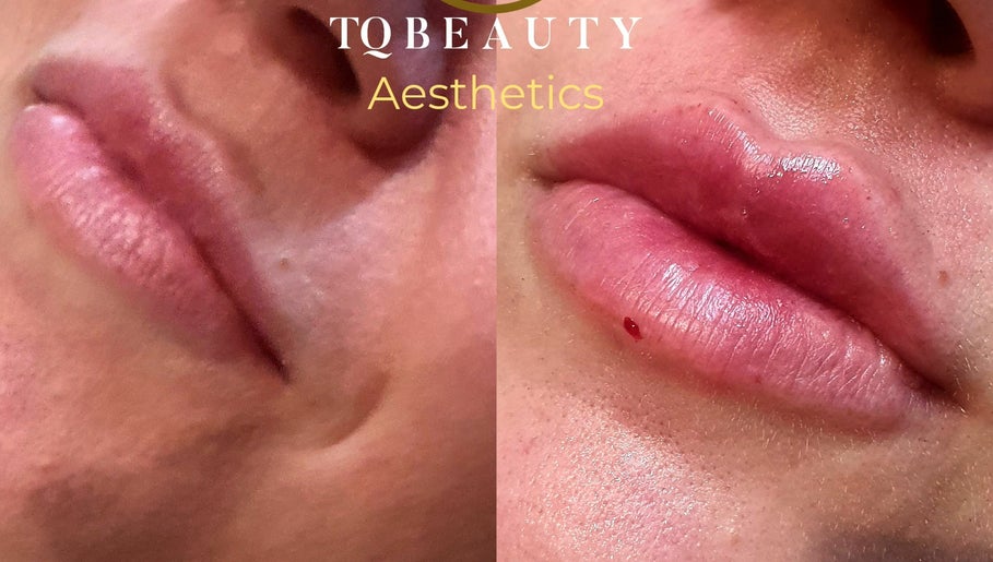 Tq Beauty Aesthetics  image 1