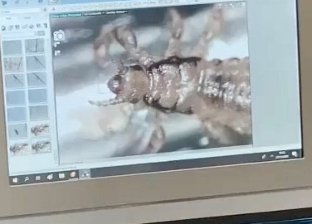 Monitor con immagine ingrandita di un cuoio capelluto al Gogo Pidocchio - Firenze, Toscana, IT.