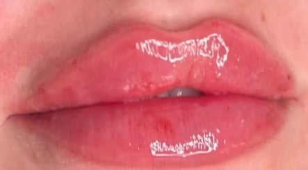 Close-up of glossy lips at Sian Carrie Studio, Chelmsford, England, GB showcasing beauty treatment.
