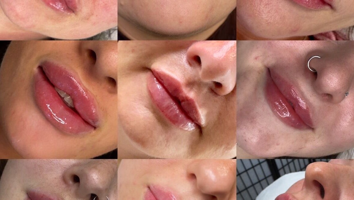 Collection of lip enhancements at Dream Face by Tess Studio, Manea, England, GB. Showcasing glossy, transformed lips.