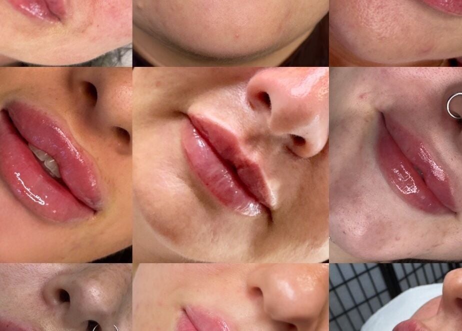 Collection of lip enhancements at Dream Face by Tess Studio, Manea, England, GB. Showcasing glossy, transformed lips.
