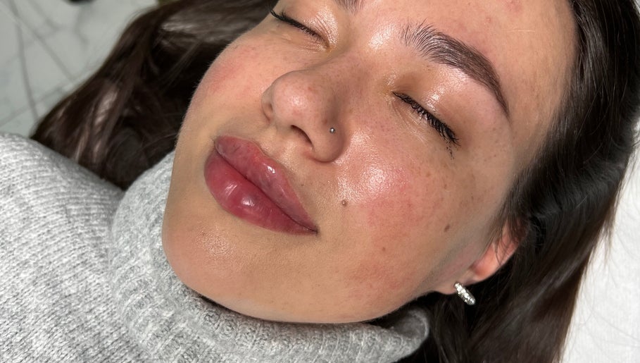 Close-up of a radiant complexion post-treatment at Ewelina Jakubus Aesthetics, Harlow, England, GB.