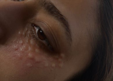 Facial skin detail at Ewelina Jakubus Aesthetics, Harlow, England, GB, showcasing skin texture.
