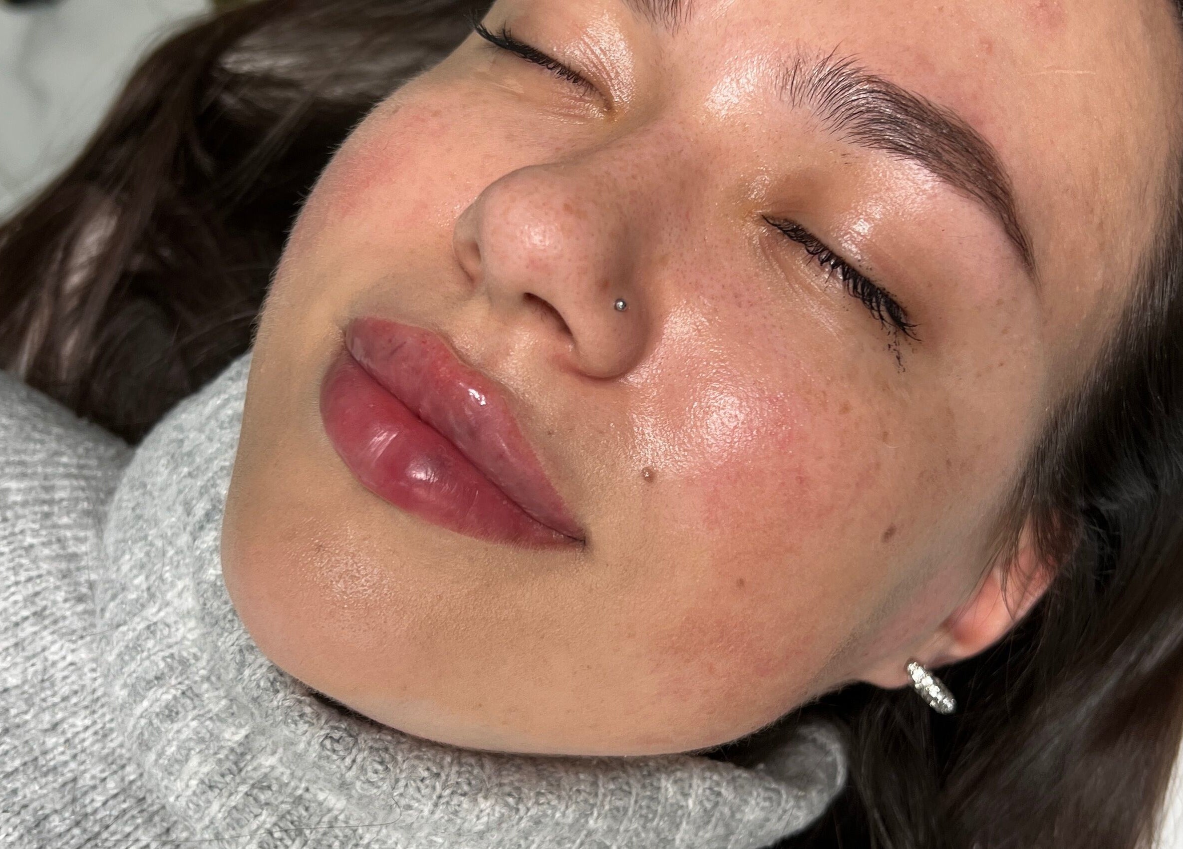 Close-up of a client's radiant skin after treatment at Ewelina Jakubus Aesthetics, Harlow, England, GB.