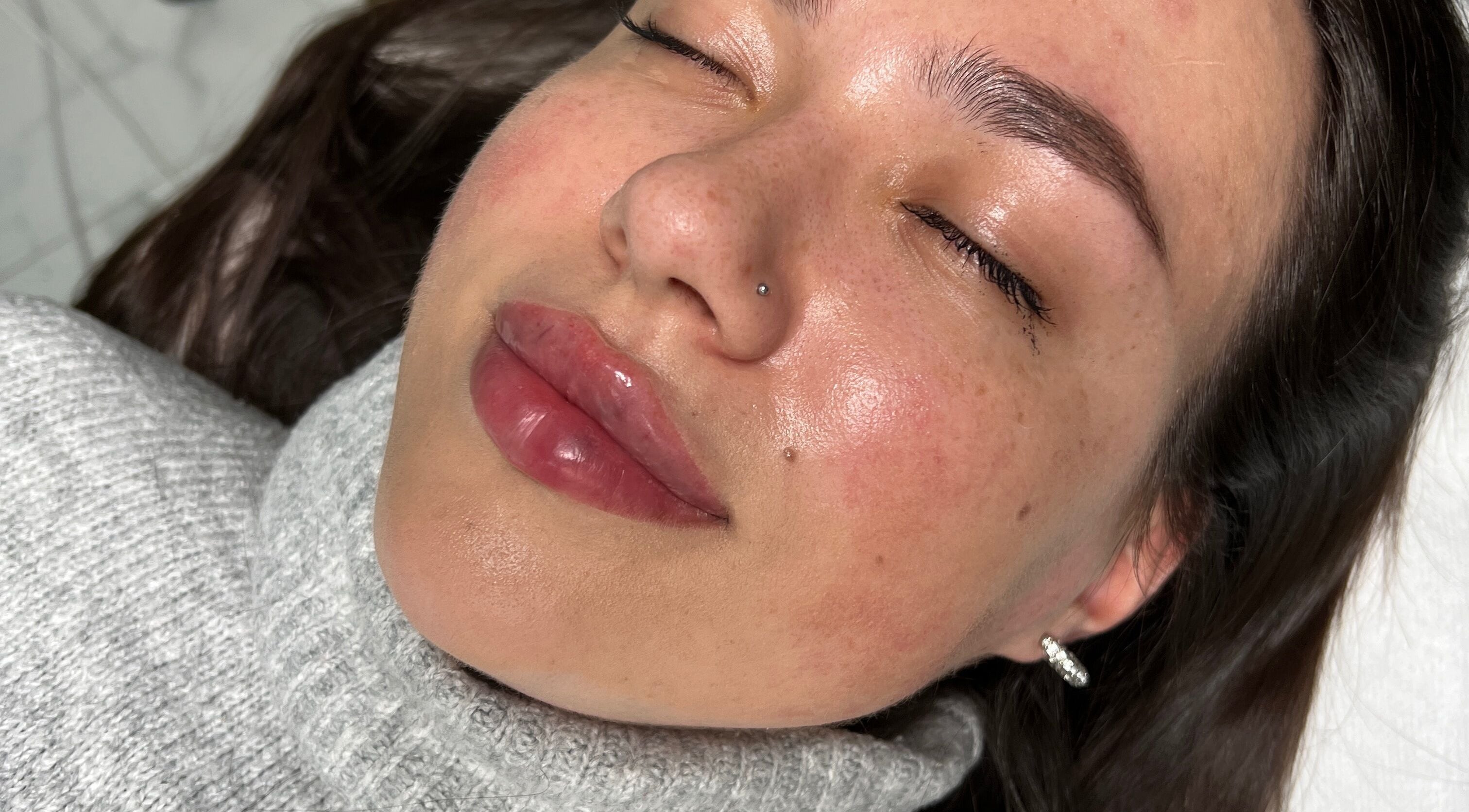 Close-up of a client's radiant skin after treatment at Ewelina Jakubus Aesthetics, Harlow, England, GB.