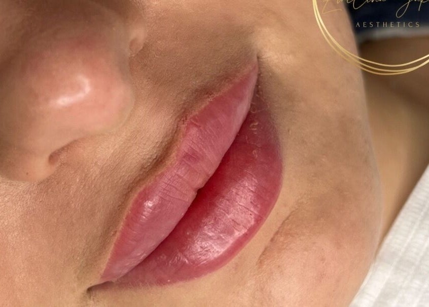 Close-up of enhanced pink lips at Ewelina Jakubus Aesthetics in Harlow, England, GB.