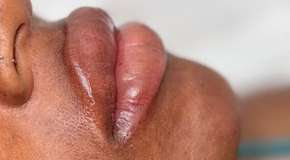 Close-up of glossy lips from Infinite Browtential, Birmingham, England, GB, showcasing beauty treatment.