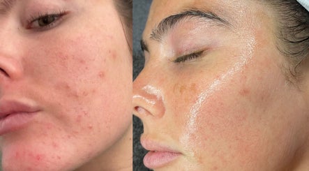 Holly Rose Spa & Aesthetics image 2