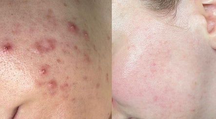 Holly Rose Spa & Aesthetics image 3