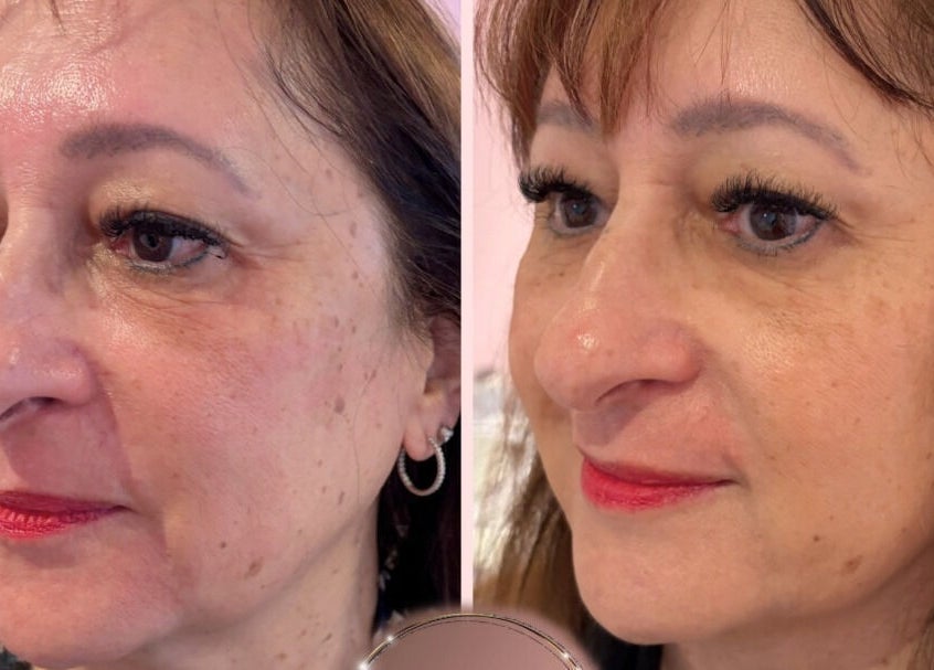 Before-and-after beauty treatment at EveLashes, Brows & Beauty in Southampton, England, GB showcasing enhanced skin glow.