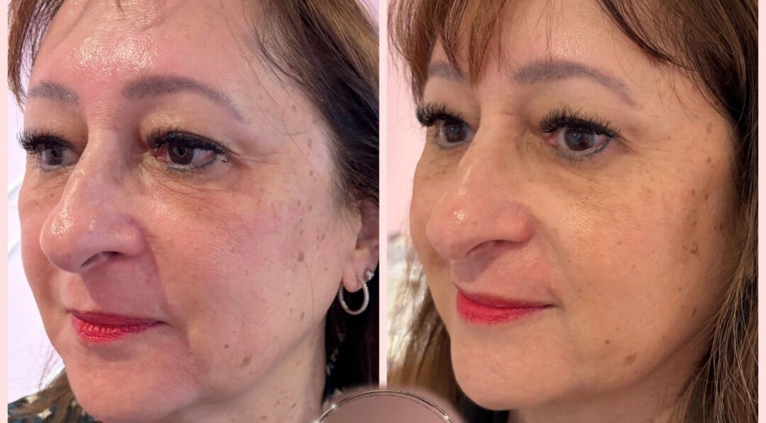 Before-and-after beauty treatment at EveLashes, Brows & Beauty in Southampton, England, GB showcasing enhanced skin glow.