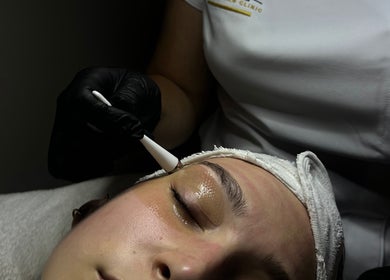 Facial treatment at Vivienne Laser & Skin Clinic, Wied Il-għajn, MT, enhancing facial beauty.