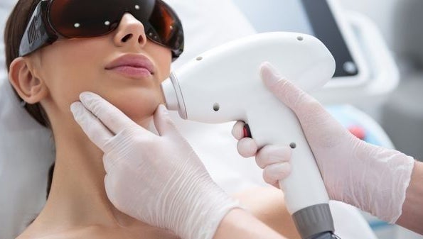 Facial laser treatment at Silky Skin Laser by Daniela in Edmonton, Alberta, CA, promoting smooth, radiant skin.