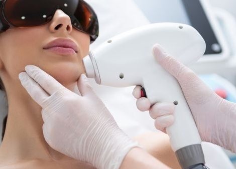 Facial laser treatment at Silky Skin Laser by Daniela in Edmonton, Alberta, CA, promoting smooth, radiant skin.