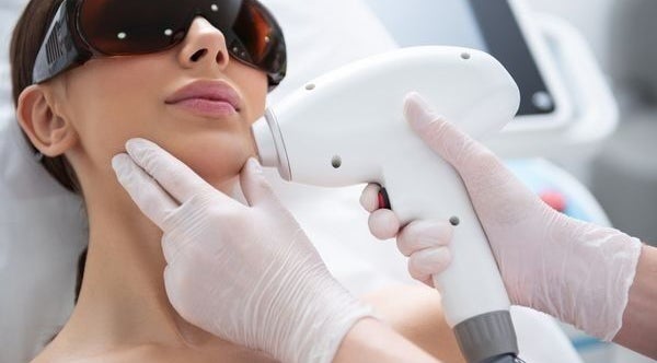 Facial laser treatment at Silky Skin Laser by Daniela in Edmonton, Alberta, CA, promoting smooth, radiant skin.